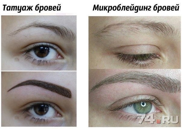 Как лечить палец если врастает ноготь Как лечить палец если врастает ноготь